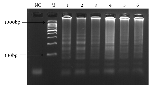 Lane (NC), negative control; (M), 100 bp DNA ladder; concentration of dNTPs is (1) 0.2 mM, (2) 0.4 mM, (3) 0.6 mM, (4) 0.8 mM, (5) 1.0 mM, (6) 1.2 mM.
