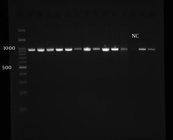 The PCR of Amplifying LACK Gene Showing 939 bp Nucleotide Bands in Isolated Leishmania