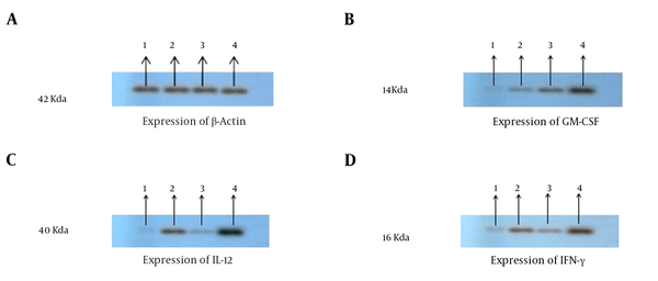 The Cytokine Expression Results of Western Blot: IL-12, GM-CSF, and INF-γ Expression Has Been Proved by Western Blotting Analysis; A, Proteins were equalized by use of β-actin expression; B, Western blotting results showed that GM-CSF expression was enhanced in the IL-12 + GM-CSF group compared with other groups; C, Western blotting results showed that the expression of IL-12 was enhanced in in the IL-12 + GM-CSF group compared with other groups. D, Western blotting results showed that the expression of IFN-γ was enhanced in the IL-12 + GM-CSF group compared with other groups.