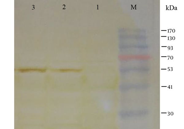 Lane M, pre-stained protein ladder; Lane 1, HEK293 cells transfected with pVAX1 (as negative control); Lane 2, detection of truncated ORF2 protein (aa 112 - 607) in the supernatant of HEK293 cells transfected with pVAX1-tPA-PADRE-truncated ORF2 (aa 112 - 607) recombinant plasmid; Lane 3, detection of truncated ORF2 protein (aa 112 - 607) in cell lysate of HEK293 cells transfected with pVAX1-tPA-PADRE-truncated ORF2 (aa 112 - 607) recombinant plasmid. A protein band about 56 kDa corresponding to tPA-PADRE-truncated ORF2 (aa 112 - 607) recombinant protein is detected.