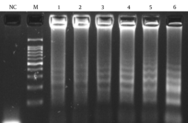 Lane (NC), negative control; (M), 100 bp DNA ladder; the concentration of MgSO4 is (1) 2 mM, (2) 4 mM, (3) 6 mM, (4) 8 mM, (5) 10 mM, (6) 12 mM.