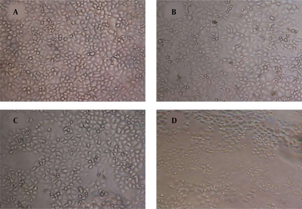 Morphological Changes of DU-145 Cells After Treatment with Various Concentrations of Gallic Acid (A - 0; B - 15; C - 30, and D - 35 µM, Respectively) for 48 Hours