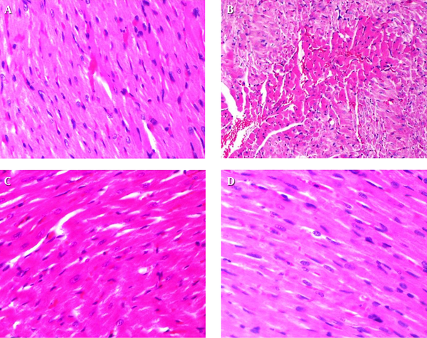 Paraffin embedded tissue blocks were stained with H and E and examined with 40× magnification. A, NS treated; B, ATO treated; C, ATO+MONT treated; D, MONT treated. NS, normal saline; ATO, arsenic trioxide; MONT, montelukast.