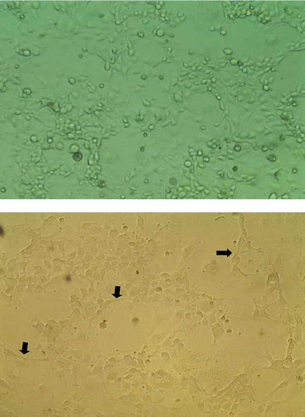 The cells with surface projections appeared in active phenotype 24 hours post- TGF-β treatment (filled arrow). Pictures were taken using a Zeiss inverted microscope (40 ×).