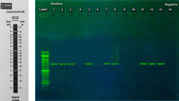 The Result of Agarose Gel Electrophoresis of PCR Product