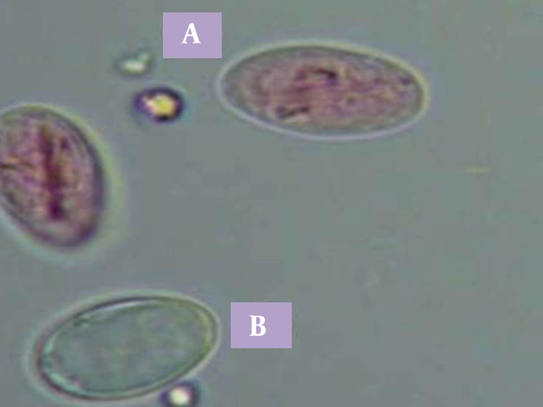 Cysts that absorbed dye were recorded as dead (A) and otherwise, with no absorbed dye were considered potentially viable (B).