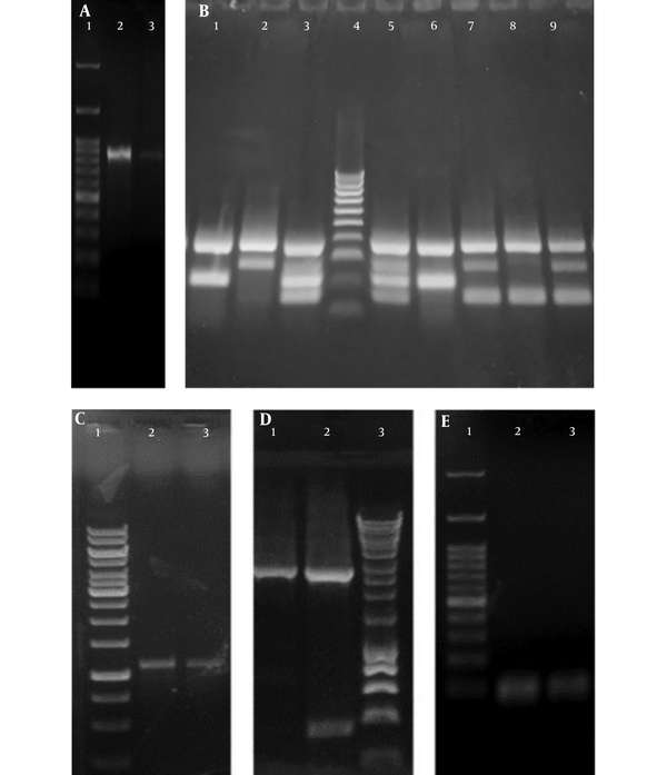 A, Agarose gel of the Polymerase Chain Reaction amplification product of uspA where Lane 1: One Mark 100 DNA Ladder (100 bp, 200 bp, 300 bp, 400 bp, 500 bp, 600 bp, 700 bp, 800 bp, 900 bp, 1000 bp, 1500 bp, 3000 bp) (GeneDireX, USA) Lane 2, 3: uspA band of the exact size of 884 bp in E. coli ATCC 25922 and a UPEC isolate, respectively; B, Agarose gel of the phylogenetic multiplex Polymerase Chain Reaction amplification products where: Lane 1, 6: Phylogenetic group A showing specific bands of gadA (373 bp) and yjaA (216 bp). Lane 2: Phylogenetic group D showing specific bands of gadA (373 bp) and chuA (281 bp). Lane 3, 5: Phylogenetic group B2 showing specific bands of gadA (373 bp), chuA (281 bp) and yjaA (216 bp) and DNA fragment TspE4.C2 (152 bp). Lane 4: HyperLadder™ 100bp (100 bp, 200 bp, 300 bp, 400 bp, 500 bp, 600 bp, 700 bp, 800 bp, 900 bp, 1013bp) (Bioline, UK). Lane 7, 9: Phylogenetic group D showing specific bands of gadA (373 bp), chuA (281 bp) and DNA fragment TspE4.C2 (152 bp). Lane 8: Phylogenetic group B1 of E. coli ATCC 25922 showing specific bands of gadA (373 bp) and DNA fragment TspE4.C2 (152 bp); C, Agarose gel of the Polymerase Chain Reaction amplification product of acrA where: Lane 1: GeneRuler 1 kb DNA Ladder (250 bp, 500 bp, 750 bp, 1000 bp, 1500 bp, 2000 bp, 2500 bp, 3000 bp, 3500 bp, 4000 bp, 5000 bp, 6000 bp, 8000 bp, 10000 bp). Lane 2 - 3: acrA band of the exact size of 1078 bp. D, Agarose gel of the Polymerase Chain Reaction amplification product of acrB where: Lane 1 - 2: acrB band of the exact size of 2730 bp. Lane 3: HyperLadder™ 1 Kb (200 bp, 400 bp, 600 bp, 1000 bp, 1500 bp, 2000 bp, 2500 bp, 3000 bp, 4000 bp, 5000 bp, 6000 bp, 8000 bp,10037bp) (Bioline, UK); E, Agarose gel of the Polymerase Chain Reaction amplification product of tolC where: Lane 1: One Mark 100 DNA Ladder  (100 bp, 200 bp, 300 bp, 400 bp, 500 bp, 600 bp, 700 bp, 800 bp, 900 bp, 1000 bp, 1500 bp, 3000 bp) (GeneDireX, USA). Lane 2 - 3: tolC PCR band of the exact size of 100 bp.