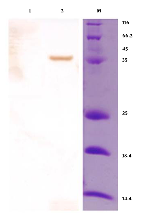 Western Blot Analysis That Confirms the Presence of Recombinant Mtb32C-HBHA Protein (36 kDa Protein Band) in Transformed Bacteria (Lane 1); (Lane 2): Negative Control; M: Protein Size Marker (Fermentas, Germany)