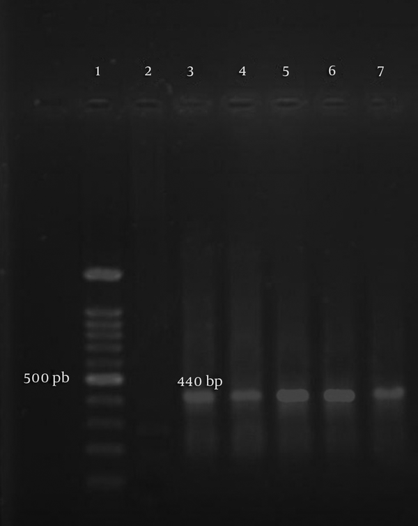Lane 1: Ladder of 100 bp (Cinnagen, Iran), lane 2: Negative control (distilled water), lane 3: Positive control (M. pneumoniae; GenBank: KX018790.1.), lanes 4-7: M. pneumoniae from clinical samples.