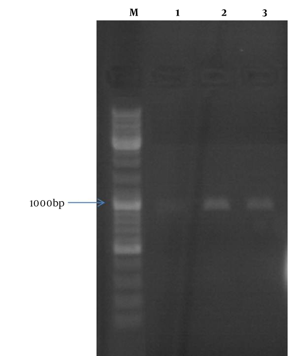 Colony-PCR Results That Show Amplification of About 1000 bp of mtb32C-hbha Fragment Using mtb32C-hbha Specific Primers (lane 2, 3); Lane M: 100 bp DNA Size Marker (Fermentas, Germany)