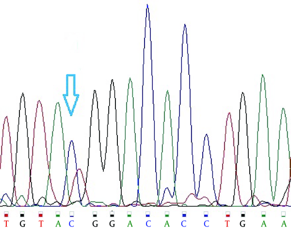 Sequencing Polymorphism rs2476601, Heterozygous Samples (CT)