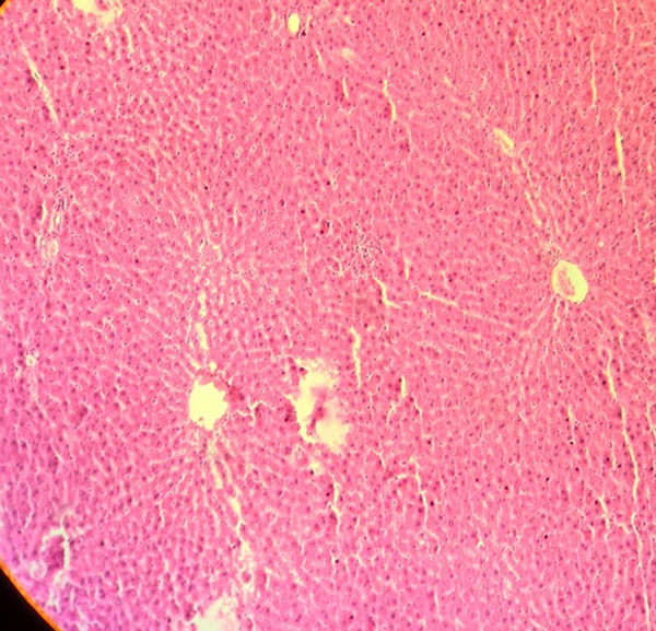 Microscopic image (10 ×) of liver tissue in rats exposed to 0.5 mT magnetic field for 2 weeks, which shows no changes relative to the control Group