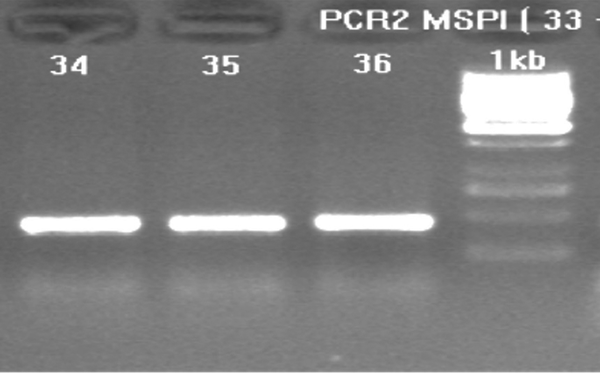 Lanes 1 to 3 are PCR products of three samples and M is 1 Kb DNA size Marker.
