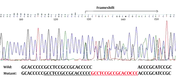 The nm_023067:c.855_871dup (p.h291rfs*71) Mutation in the foxl2 Gene in the Patients of the Second Family.