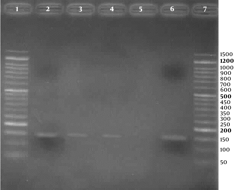 Agarose gel (2%) electrophoresis of PCR products for detection of Human papillomavirus, using HPV general primers; Lanes 1 and 7: 50 bp DNA Ladder (CinnaClon, Iran); Lanes 2 to 4: three positive results (150 bp bands); Lane 5: negative control; Lane 6: positive control