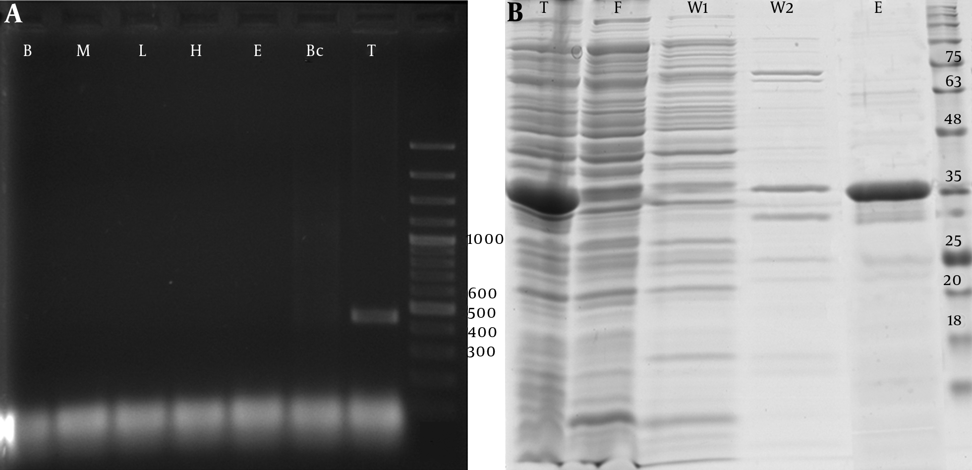 A, PCR amplification analysis of the 426 bp fragment of PTHrP ‎coding cDNA derived from human cDNA libraries of blood cells (B), bone marrow ‎derived MSCs (M), liver tissue (L), hepatocytes cells (H), embryonic stem cells ‎‎(E), breast cancer cells (Bc), and testis tissue (T), b, SDS-PAGE analysis of ‎recombinant PTHrP expressed by pET 32a transformed Rosetta™ 2 competent ‎cells at 37°C for 6 hours. Total soluble cell expressed proteins (T) were purified by ‎‎6xHis/Ni-NTA system, washed with 20 (W1) and 50 (W2) mM wash buffers and ‎eluted (E) using 300 mM elution buffer. F: Flow-through fraction of Ni-NTA resin ‎loaded soluble protein.