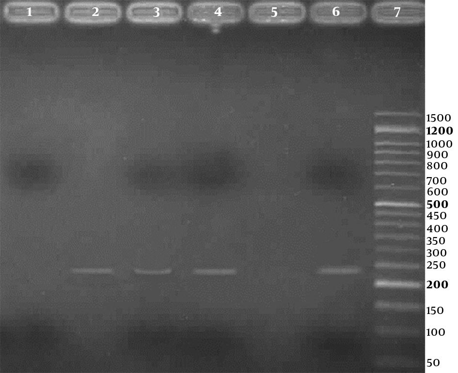 Agarose gel (2%) electrophoresis of PCR products for detection of high risk human papillomavirus, using type specific primers; Lane 1: a negative result; Lanes 2 to 4: three positive results (236 bp bands); Lane 5: negative control; Lane 6: positive control; Line 7: 50 bp DNA Ladder (CinnaClon, Iran)