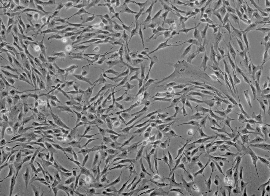 Fibroblast cells from the human skin (× 100)