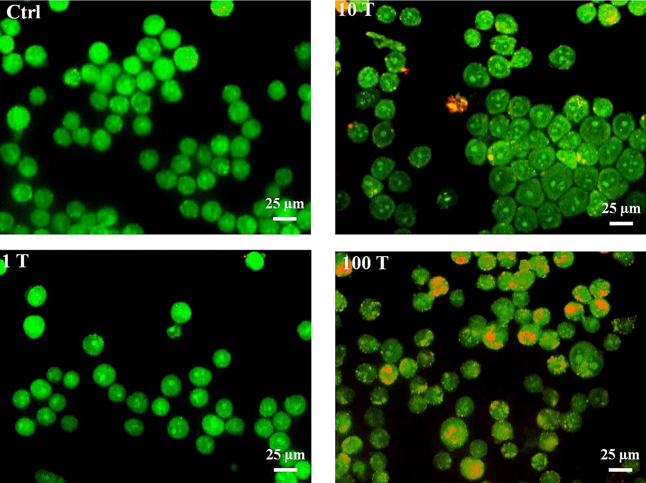Effects of TiO2 NPs on detection of acidic vesicular organelles and autophagy in A375 cells. Cells were treated with different concentrations of NPs (1, 10 and 100 μg/mL), then harvested and stained with AO for 24 hours. The content of acidic vacuoles (red dots) was evaluated by fluorescence microscopy (magnification 32X).