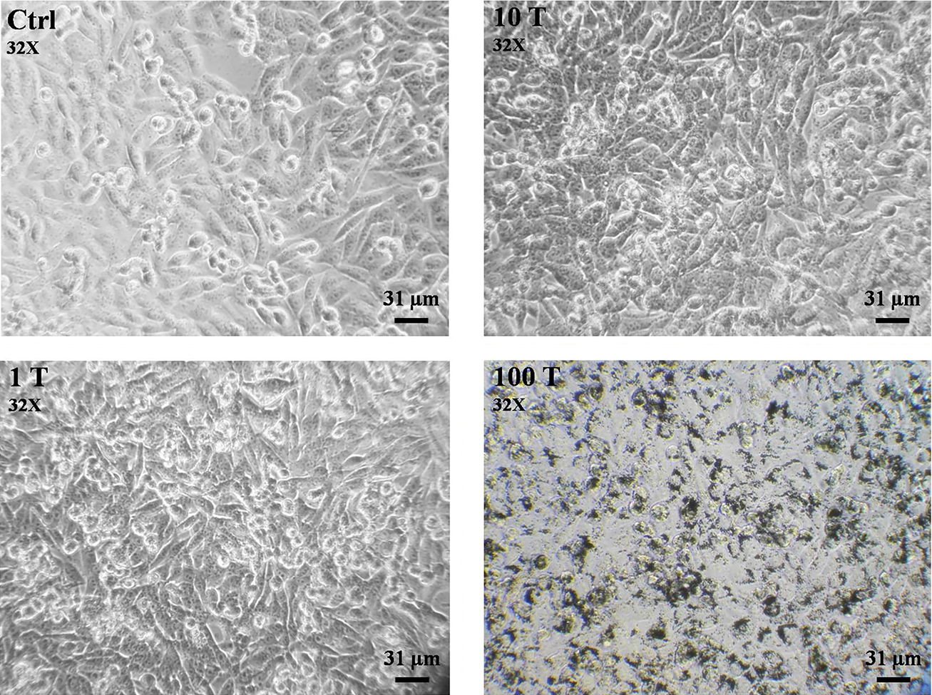 Morphological study of A375 cells exposed to TiO2 NPs. Cells were treated with different concentrations of TiO2 NPs (1 - 100 μg/mL) for 24 hours and morphological changes were studied by an inverted light microscope (magnification 32X).
