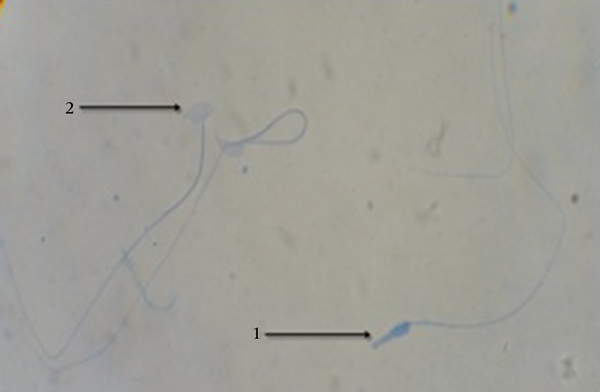 1, Sperms with immature nuclei show heads in dark blue; 2, sperms with mature nuclei represent pale blue head (Aniline blue, 1000 X).