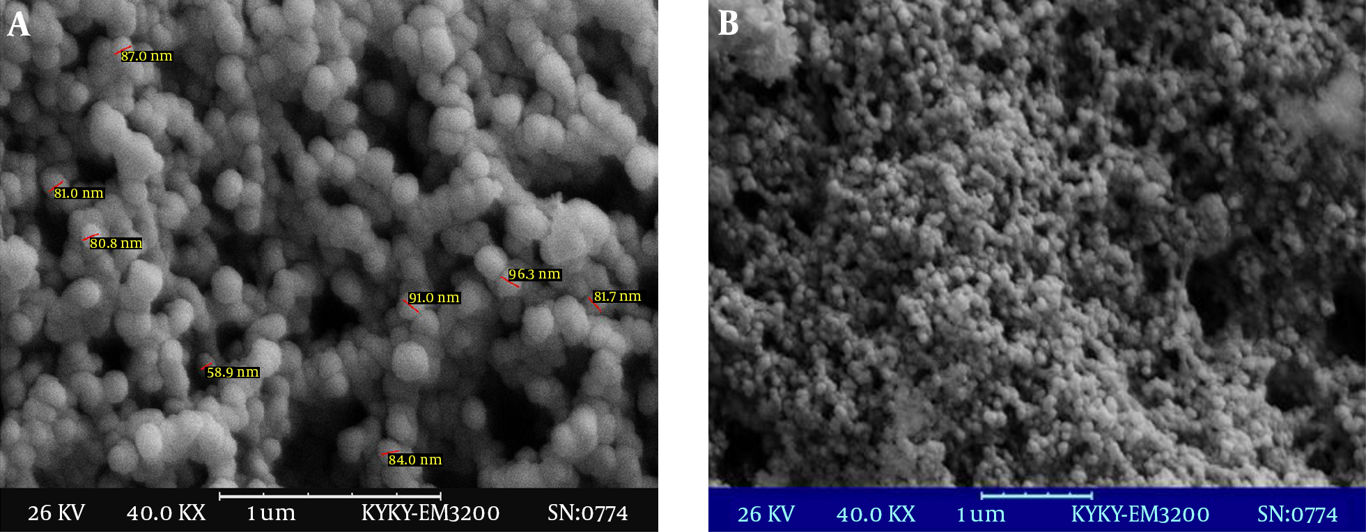 A, Image of Nanopartilces with High Magnification; B, Image of Nanoparticles with Low Magnifications