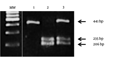 Restriction analysis of TP53 codon polymorphism. Lane 1, 2, and 3, samples showing homozygous profile for arginine, homozygous profile for proline, and heterozygous profile, respectively. MW: DNA molecular weight, 100 bp marker. The PCR product corresponding to the arginine allele was not cleaved by BtgI and had a length of 441 bp, the proline allele was cleaved by BtgI with two fragments of 235 bp and 206 bp.