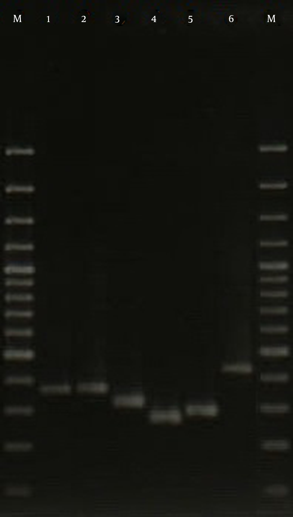 Lane M, 100-bp DNA Ladder (Fermentas, UK); Lanes 1 to 6, the Variable PCR Product of spa