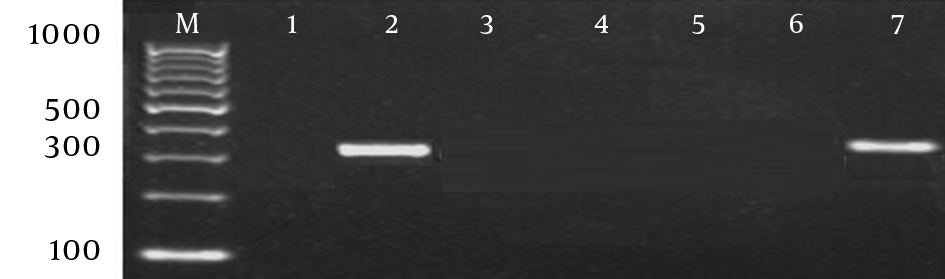 Gel electrophoresis image of mefA resistance gene; M: 100-bp ladder; lane 1: S. pneumoniae ATCC 49619 as negative control; lane 2: S. pneumoniae ATCC 700677 as positive control; lane 3 - 6: representative S. pyogenes isolates; lane 7: positive isolate with mefA gene (348 bp)