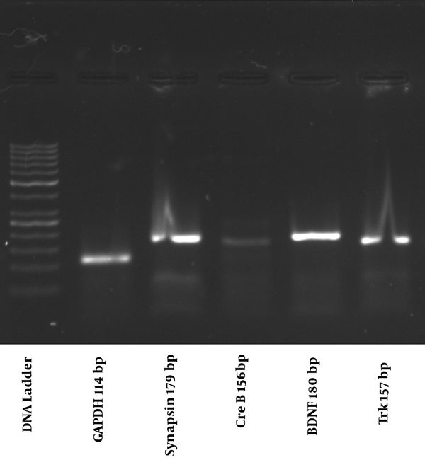 Electropherosis Gel of the Synapsin (179 bp), Trk (157 bp), CreB (156 bp), GAPDH (114 bp), and BDNF (180 bp) genes