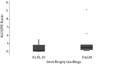 SGOT/Platelet Ratio for Prognosis of Grading of Liver Biopsy