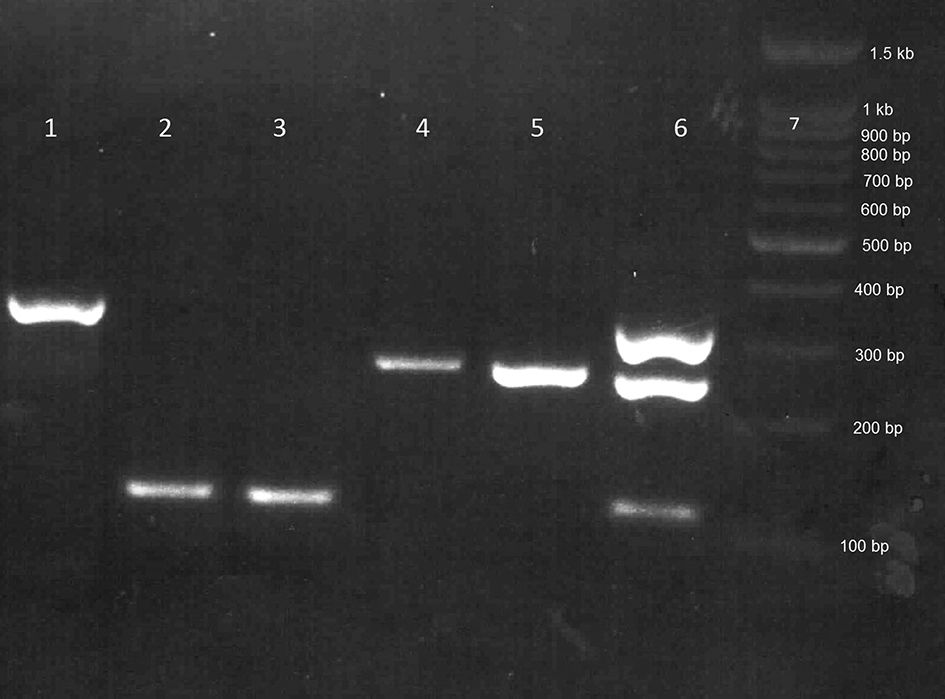 Electrophoresis pattern of PCR products of HAV, HBV, and HCV at the detection step. The products length were 330 bp for HAV (lane 1), 118 bp for HBV (lane 2, 3) and 276 bp for HCV (lane 4, 5). Lane 6: positive controls, lane 7: 100 bp DNA ladder.