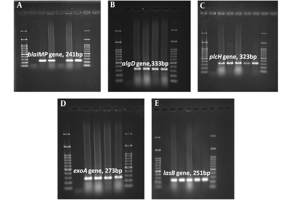 Agarose Gel Electrophoresis of the Amplified Resistance (blaIMP) and Virulenc (algD, plcH, exoA, lasB) Genes by PCR Assay. A, blaIMP gene (241 bp); B, algD gene (333 bp); C, plcH gene (323 bp); D, exoA gene (273 bp); E, lasB gene (251 bp). 100 bp size marker (DNA ladder) was used in agarose gel electrophoresis.