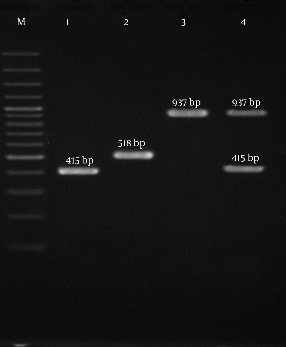 Lane M, 100-bp DNA Ladder (Fermentas, UK); Lane 1 SCCmec Type I, lane 2 SCCmec Type III, Lane 3 SCCmec Type II, and Lane 4 SCCmec Type IV