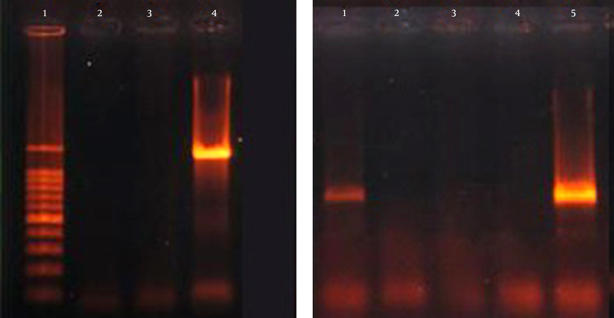A, Lane 1, 100 bp DNA Marker; Lane 2, Negative Control; Lane 4, Amplification of K1 (1283 bp); B, Lane 1, 5, Amplification of K20 (741 bp); Lane 2, Negative Control