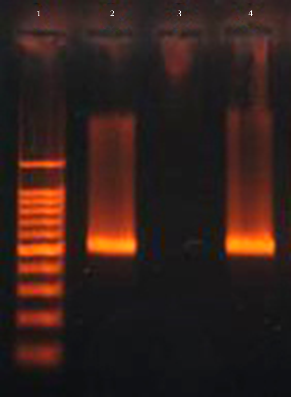 Lane 1, 100 bp DNA Marker; Lane 2, 4, Amplification of blaCTX-M-15 Gene (550 bp); Lane 3, Negative Control