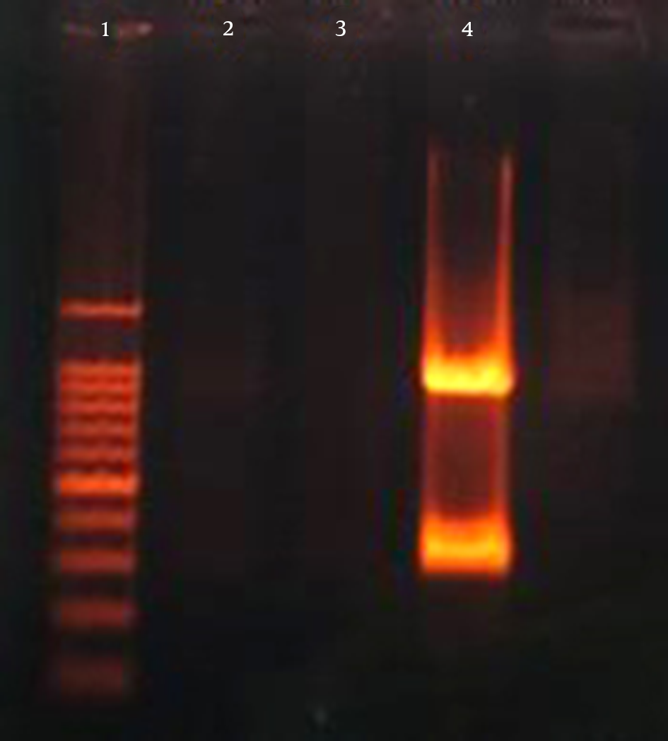 Lane 1, 100 bp DNA Marker; Lane 2, Negative Control; Lane 4, Amplification of rmpA Gene (322 bp) and iucB Gene (948 bp)