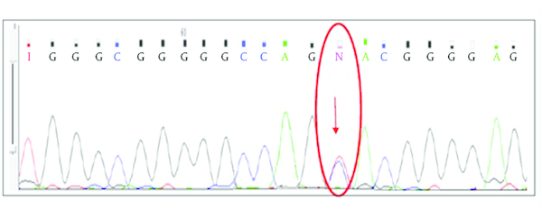 The nucleotide change T &gt; C at nucleotide 253 was detectable in 2.56% of referred Imatinib resistant CML patients. The position of the mutation is circled.