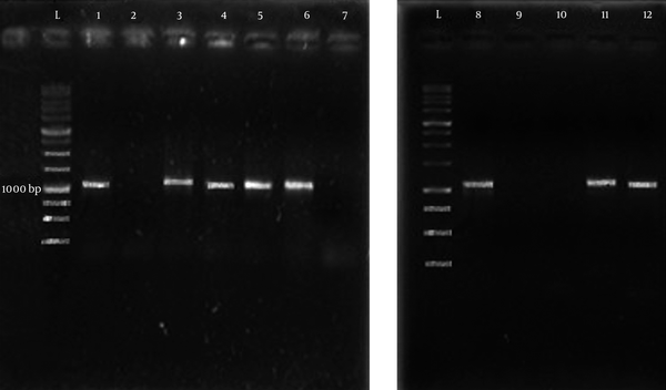 The presence of fimH gene (1047 bp) is seen in samples 1, 3, 4, 5, 6, 8, 11 and 12. Lane L indicates the DNA ladder