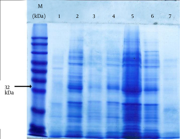 Only seven samples (out of 12 samples) have been shown here. The presence of FimH protein (32 kDa) is seen in samples 2, 3, 4, 5 and 6. Lane Mw indicates the protein ladder