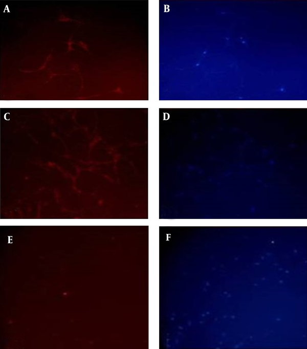 Visualizing under invert fluorescent microscope; A and B, β-tubulin III marker and DAPI; C and D, γ-enolase marker and DAPI; E and F, MAP-2 and DAPI. Scale bar is 100 µm.
