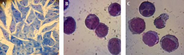 A, Normal control PC3 cells; B, PC3 cells treated with 3.13 mg/mL Bane extract; C, PC3 cells treated with 6.25 mg/mL Bane extract. Apoptotic body formation with an increase in cytoplasm was observed.