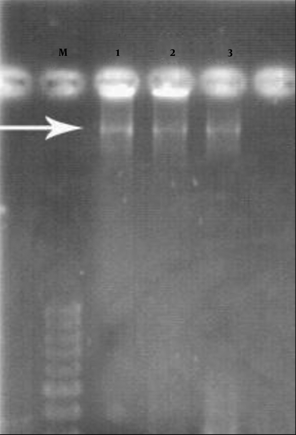 DNA Extracted from Cultured Klebsiella pneumonia, Electrophoresis in 1% Agarose Gel