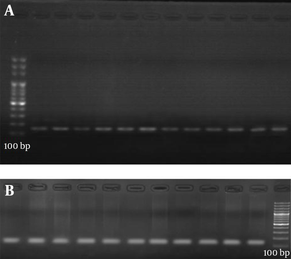 A, PCR analysis of A1298C and B, C677T mutations on the MTHFR gene in pregnant women with mutations.