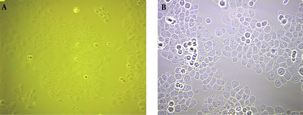A, MCF-7 Normal Cells; B, MCF-7 UV Exposed Cells After 3 Hours