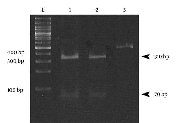 Lane L, 100 bp DNA ladder (Fermentas); lanes 2 and 3 contain 310 and 70 bp DNA fragments produced from enzymatic digestion; lane 3, undigested 450 bp product of HPV PCR as a control.