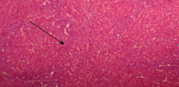 A Liver Section in the Cirrhotic Group Treated with CAPE (1 µg/kg) Hematoxylin Eosin Staining; Magnification × 100