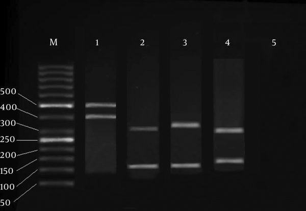 M, Molecular marker at 50 bp, Line 1, Non-consistent sample with C. luciliae and C. fasciculate standards, Line 2, Band profiles generated by DdeI enzyme, Line 3, Band profiles generated by ScrFI enzyme, Line 4, Band profiles generated by TaqI enzyme, Line 5, Negative control