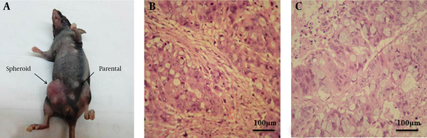 (A) The photograph of a representative mouse has taken at 7 weeks after cell transplantation (B) Haematoxylin-eosin analysis of mouse xenografts have generated by spheres expanded in culture (400 ×). (C) Haematoxylin-eosin analysis of mouse xenografts have generated by parental cells expanded in culture (400 ×)