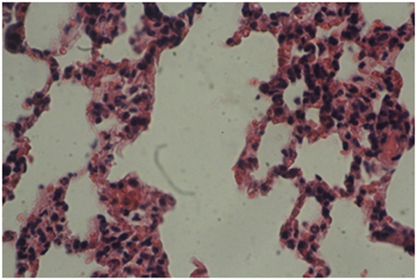 Light Micrographs of Sections in the Lung of TiO2-Treated Rat Received 10 ppm Every Day for 7 Successive Days (Group 1) Demonstrating of Changes Histopathology.